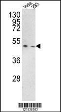 Anti-TMPRSS3 Rabbit Polyclonal Antibody (AP (Alkaline Phosphatase))