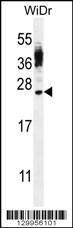 Anti-CT45A4 Rabbit Polyclonal Antibody (PE (Phycoerythrin))