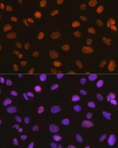 Immunofluorescence analysis of U-2 OS cells using Anti-SNF2H Antibody [ARC0795] (A308440) at a dilution of 1:100 (40x lens). DAPI was used to stain the cell nuclei (blue)