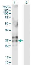 Anti-RNASE2 Rabbit Polyclonal Antibody