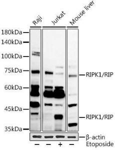 Western blot analysis of extracts of various cell lines, using Anti-RIP Antibody (A10146) at 1:1,000 dilution