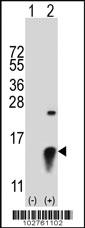 Anti-SUMO2 Rabbit Polyclonal Antibody