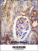 Anti-DYNLRB2 Rabbit Polyclonal Antibody (FITC (Fluorescein Isothiocyanate))