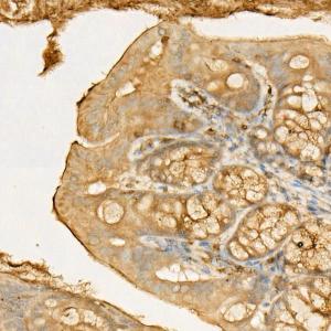 Immunohistochemistry analysis of paraffin-embedded mouse colon using Anti-RIP Antibody (A10146) at a dilution of 1:50 (40X lens). Perform high pressure antigen retrieval with 10 mM citrate buffer pH 6.0 before commencing with IHC staining protocol