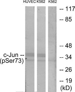 Western blot analysis of lysates from HUVEC cells treated with TNF 20 ng/ml 5' and K562 cells treated with TNF 20 ng/ml 5' using Anti-c-Jun (phospho Ser73) Antibody. The right hand lane represents a negative control, where the antibody is blocked by the immunising peptide