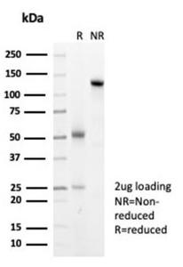 SDS-PAGE analysis of Anti-HSP27 Antibody [HSPB1/7038R] under non-reduced and reduced conditions; showing intact IgG and intact heavy and light chains, respectively SDS-PAGE analysis confirms the integrity and purity of the antibody