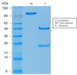 SDS-PAGE analysis of Anti-p53 Antibody [rTP53/1739] under non-reduced and reduced conditions; showing intact IgG and intact heavy and light chains, respectively. SDS-PAGE analysis confirms the integrity and purity of the Antibody