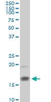 Anti-RNASE2 Rabbit Polyclonal Antibody