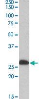 Anti-ETFB Goat Polyclonal Antibody