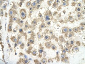 Anti-GPC3 Rabbit Polyclonal Antibody