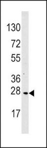 Anti-MOB1B Rabbit Polyclonal Antibody