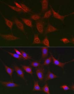 Immunofluorescence analysis of NIH/3T3 cells using Anti-RIP Antibody (A10146) at a dilution of 1:100 (40X lens). DAPI was used to stain the cell nuclei (blue)