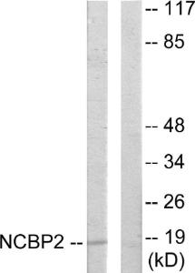 Western blot analysis of lysates from COLO205 cells using Anti-NCBP2 Antibody. The right hand lane represents a negative control, where the antibody is blocked by the immunising peptide