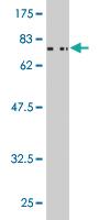 Anti-CSNK1G2 Mouse Monoclonal Antibody [clone: 2E6]