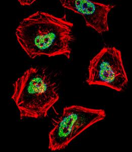 Anti-NCOR1 Rabbit Polyclonal Antibody