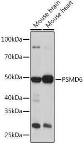 Western blot analysis of extracts of various cell lines, using Anti-PSMD6 Antibody (A308441) at 1:1,000 dilution The secondary antibody was Goat Anti-Rabbit IgG H&L Antibody (HRP) at 1:10,000 dilution Lysates/proteins were present at 25 µg per lane