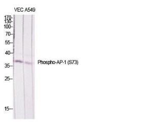 Western blot analysis of various cells using Anti-c-Jun (phospho Ser73) Antibody