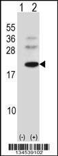 Anti-BARX1 Rabbit Polyclonal Antibody (FITC (Fluorescein Isothiocyanate))