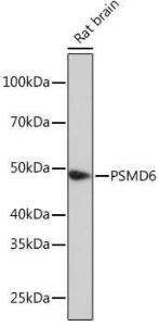 Western blot analysis of extracts of Rat brain, using Anti-PSMD6 Antibody (A308441) at 1:1,000 dilution The secondary antibody was Goat Anti-Rabbit IgG H&L Antibody (HRP) at 1:10,000 dilution Lysates/proteins were present at 25 µg per lane