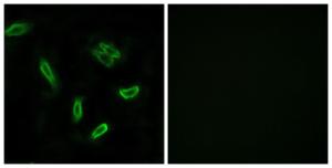 Immunofluorescence analysis of A549 cells using Anti-SLC27A5 Antibody The right hand panel represents a negative control, where the antibody was pre-incubated with the immunising peptide