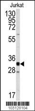 Anti-CDK2 Rabbit Polyclonal Antibody