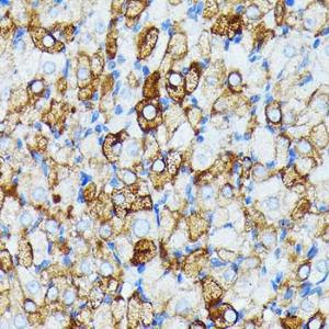 Immunohistochemistry analysis of paraffin-embedded rat ovary using Anti-JAK1 Antibody [ARC0434] (A80915) at a dilution of 1:100 (40X lens). Perform microwave antigen retrieval with 10 mM PBS buffer pH 7.2 before commencing with IHC staining protocol