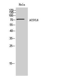 Western blot analysis of Hela cells using Anti-SLC27A5 Antibody