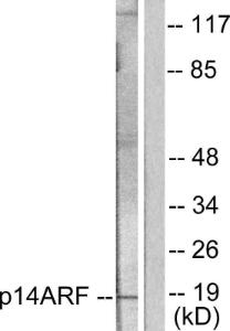 Anti-CDKN2A/p14ARF Rabbit Polyclonal Antibody