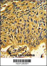 Anti-CDK2 Rabbit Polyclonal Antibody