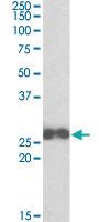 Anti-ARHGDIB Goat Polyclonal Antibody