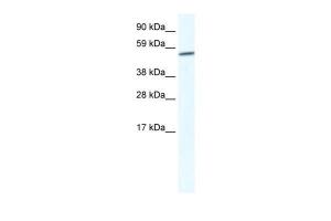 Anti-GPC3 Rabbit Polyclonal Antibody