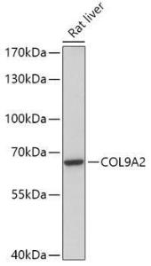 Western blot analysis of extracts of Rat liver, using Anti-COL9A2 Antibody (A308443) at 1:1,000 dilution