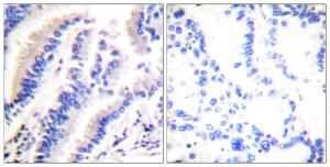 Antibody anti-FADD A99898-100 100 µg