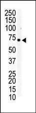 Anti-EPHB6 Rabbit Polyclonal Antibody