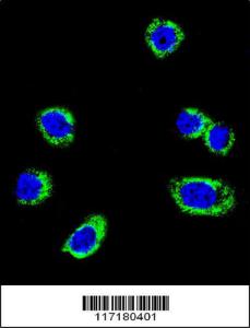 Anti-BRAF Rabbit Polyclonal Antibody (FITC (Fluorescein))