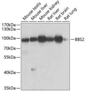 Western blot analysis of extracts of various cell lines, using Anti-BBS2 Antibody (A10150) at 1:1,000 dilution. The secondary antibody was Goat Anti-Rabbit IgG H&L Antibody (HRP) at 1:10,000 dilution.