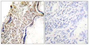 Anti-CDKN2A/p14ARF Rabbit Polyclonal Antibody