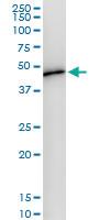 Anti-WDR4 Polyclonal Antibody Pair