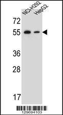 Anti-TRIM7 Rabbit Polyclonal Antibody (FITC (Fluorescein Isothiocyanate))