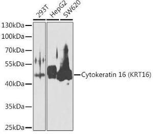 Anti-Cytokeratin 16/K16 antibody