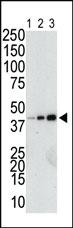 Anti-GST tag Rabbit Polyclonal Antibody