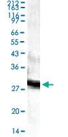 Anti-PSEN1 Rabbit Polyclonal Antibody