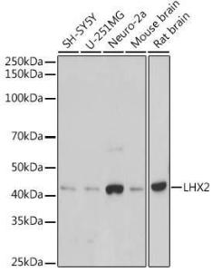 Western blot analysis of extracts of various cell lines, using Anti-Lhx2/LH2 Antibody [ARC2435] (A307496) at 1:1000 dilution. The secondary Antibody was Goat Anti-Rabbit IgG H&L Antibody (HRP) at 1:10000 dilution. Lysates/proteins were present at 25 µg per lane