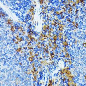 Immunohistochemistry analysis of paraffin-embedded mouse spleen using Anti-JAK1 Antibody [ARC0434] (A80915) at a dilution of 1:100 (40X lens). Perform microwave antigen retrieval with 10 mM PBS buffer pH 7.2 before commencing with IHC staining protocol