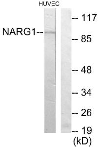 Western blot analysis of lysates from HUVEC cells using Anti-NARG1 Antibody. The right hand lane represents a negative control, where the antibody is blocked by the immunising peptide