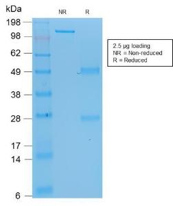 SDS-PAGE analysis of Anti-p53 Antibody [rBP53-12] under non-reduced and reduced conditions; showing intact IgG and intact heavy and light chains, respectively. SDS-PAGE analysis confirms the integrity and purity of the antibody.