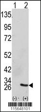 Anti-GRB2 Rabbit Polyclonal Antibody