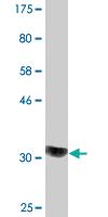 Anti-COQ2 Mouse Monoclonal Antibody [clone: 2B4]