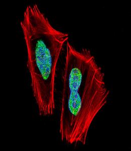 Anti-RBPJ Rabbit Polyclonal Antibody (FITC (Fluorescein Isothiocyanate))