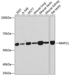 Anti-MMP11 Rabbit Monoclonal Antibody [clone: ARC0523]